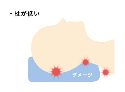 枕が低すぎるとあごが上がり、首に負担がかかる