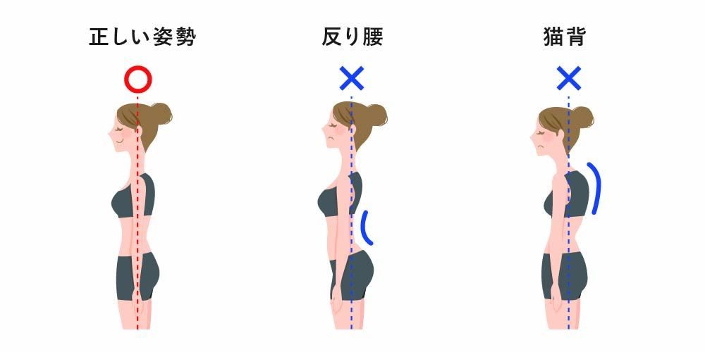 反り腰は骨盤が前傾し、背骨が腰のあたりから反った状態です。